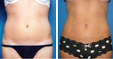 Before & After Photos